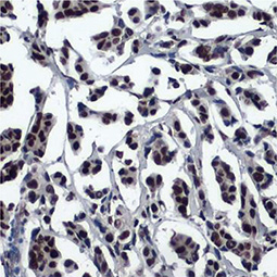 53BP1 antibody [HL275] (GTX635479)